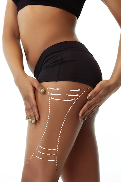 Hermosas piernas femeninas y caderas aisladas sobre fondo blanco. Belleza, cosmética, spa, depilación, tratamiento y fitness. En forma y deportista, sensual. Cuidado corporal y lifting, corrección de líneas quirúrgicas.