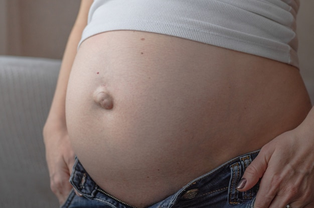 Hérnia umbilical em uma mulher grávida. Fechar-se. O conceito de saúde e vida