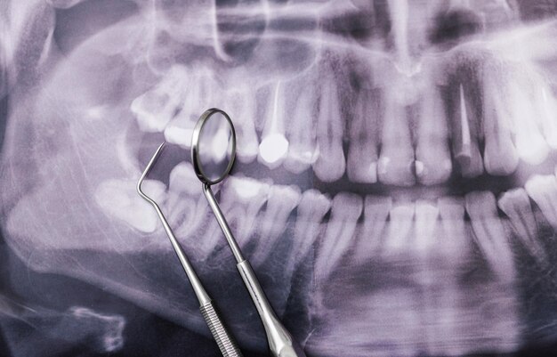 Herramientas de equipo médico del dentista en el fondo de rayos x