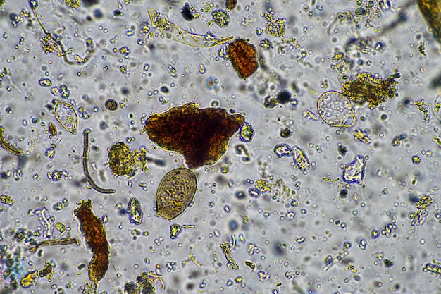 hifas fúngicas y hongos del suelo en una muestra de suelo que muestra el suelo vivo de una granja