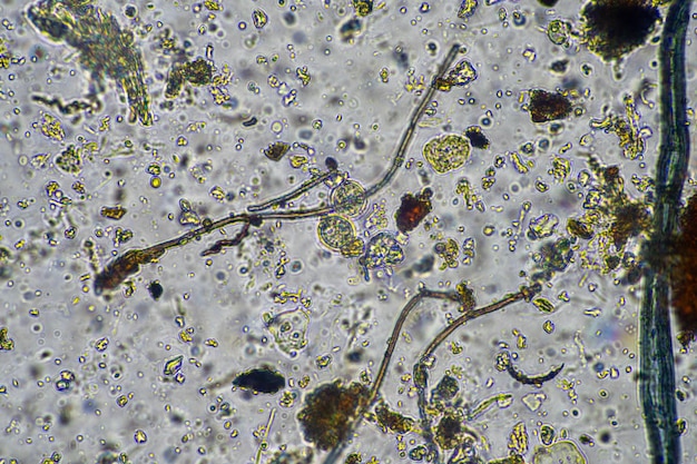 hifas fúngicas y hongos del suelo en una muestra de suelo que muestra el suelo vivo de una granja