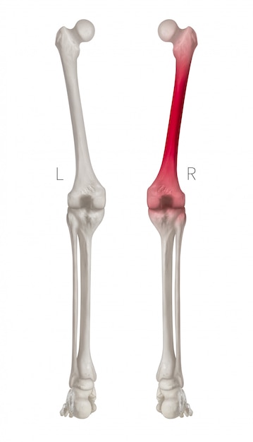 Hintere Ansicht des menschlichen Beinknochens mit roten Höhepunkten in den Oberschenkelknochenschmerz, lokalisiert auf weißem Hintergrund