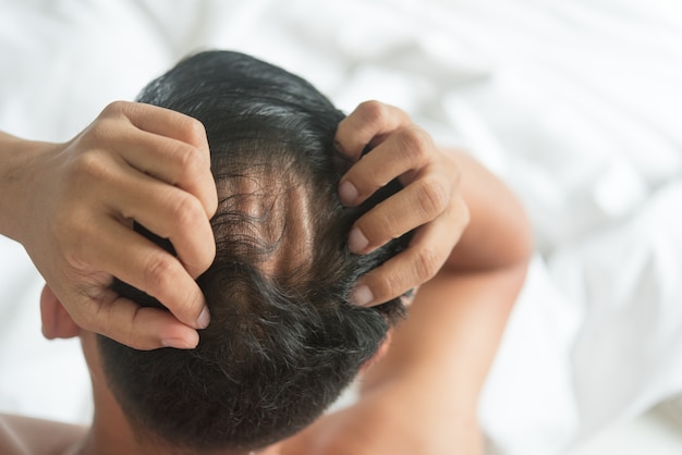 El hombre asiático está preocupado con el problema de pérdida de cabello en la cama en casa.