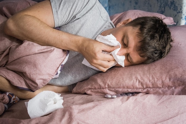 Hombre caucásico enfermo en la cama con gripe vírica o nariz mocosa rodeada de pañuelos usados