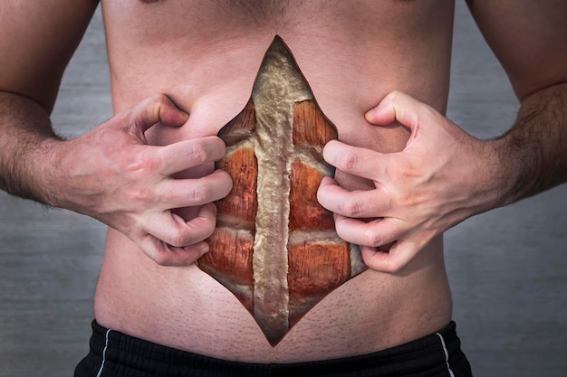 Foto el hombre era gordo pero se puso en forma grasa para los músculos del atleta debajo de la piel de un hombre joven el concepto de pérdida de peso eliminación de grasa subcutánea en el abdomen