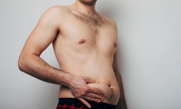 El hombre gordo con una gran barriga sacó el estómago y lo toca con las manos Hombre en riesgo de diabetes Personas obesas con diabetes