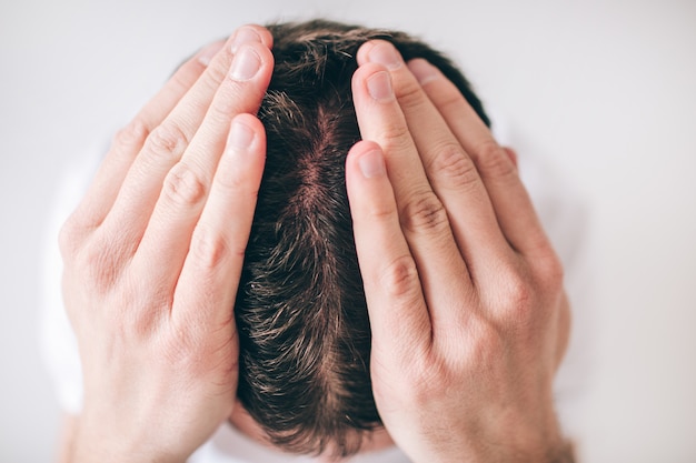 Foto hombre joven aislado sobre la pared blanca. cerrar imagen de la cabeza. problema de cabello cayendo. agarrarse las manos sobre la cabeza. caspa en la piel de la cabeza.