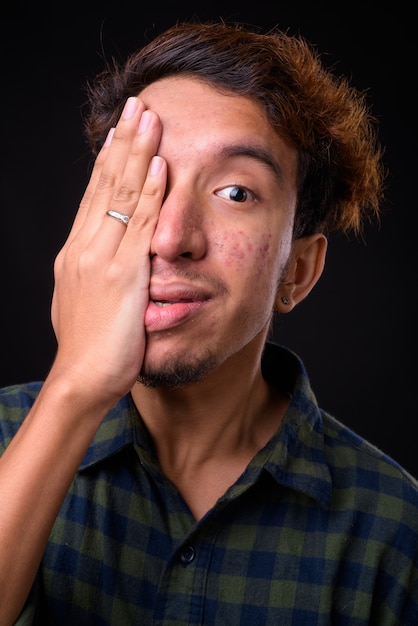 Hombre joven inconformista asiático con pelo rizado y acné contra el espacio negro