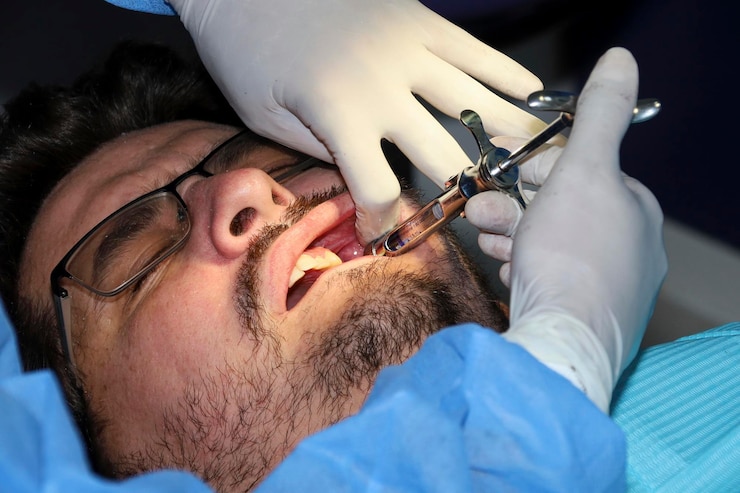 Foto un hombre con una ligera barba se somete a un procedimiento dental