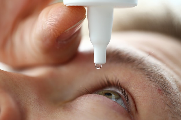 Hombre mano poniendo gotas de líquido en su ojo para resolver el problema de visión