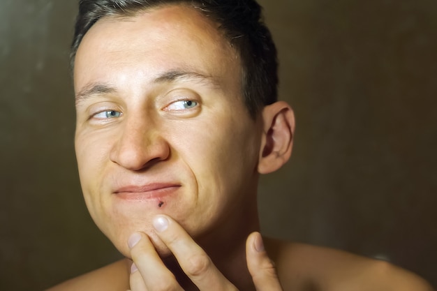 El hombre con ojos grises mira cuidadosamente el reflejo del espejo de la cara y se da cuenta de la inflamación de la decepción en la piel debajo del primer plano del labio inferior