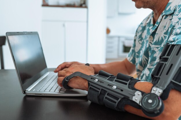 Hombre con ortesis de codo articulada ajustable escribiendo en el teclado de una computadora portátil