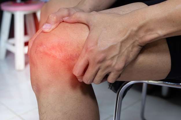 Foto el hombre pone las manos en la rodilla con dolor por la herida de la cirugía