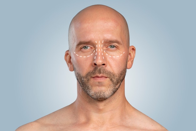 Foto hombre preparándose para la cirugía de nariz