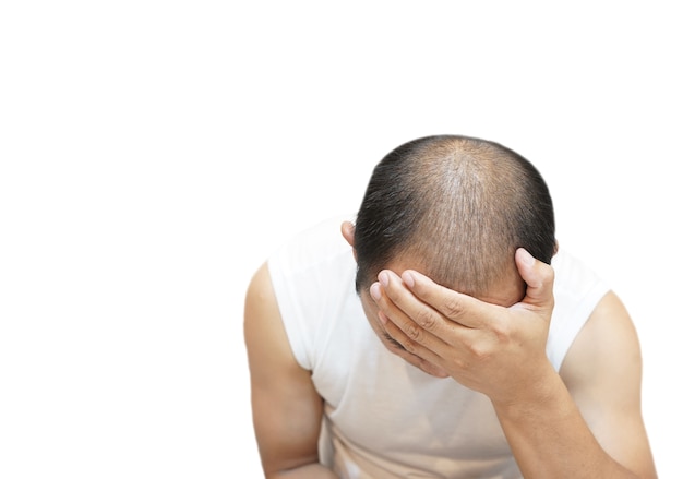 Hombre triste sobre problema de la pérdida de pelo en el fondo blanco.