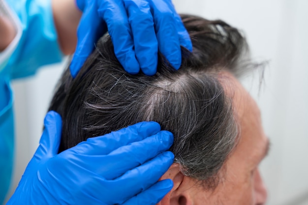 Foto homem adulto recebendo tratamento para queda de cabelo