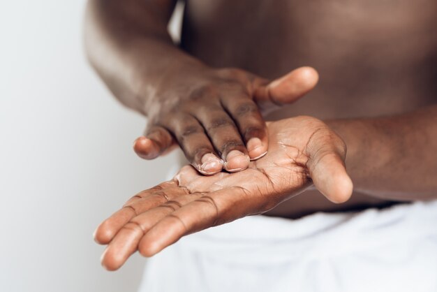 Homem americano africano, manchas, mãos