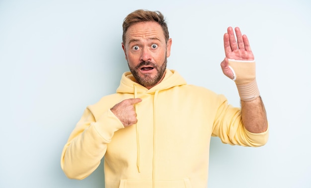 Homem bonito de meia-idade se sentindo feliz e apontando para si mesmo com um animado. conceito de mão quebrada