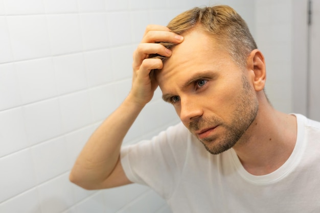 Homem branco caucasiano de meia idade com barba curta olha para o cabelo no espelho no banheiro e preocupado com a calvície O conceito do problema da perda de cabelo masculino calvície precoce e alopecia