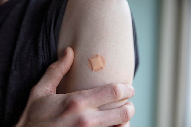 Homem caucasiano com um gesso no braço após uma injeção de vacinação
