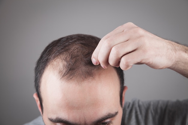 Homem caucasiano, verificando seu cabelo. Problema de queda de cabelo