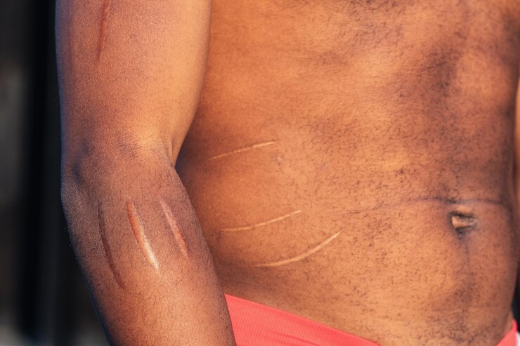 Foto homem de colheita com cicatrizes no corpo