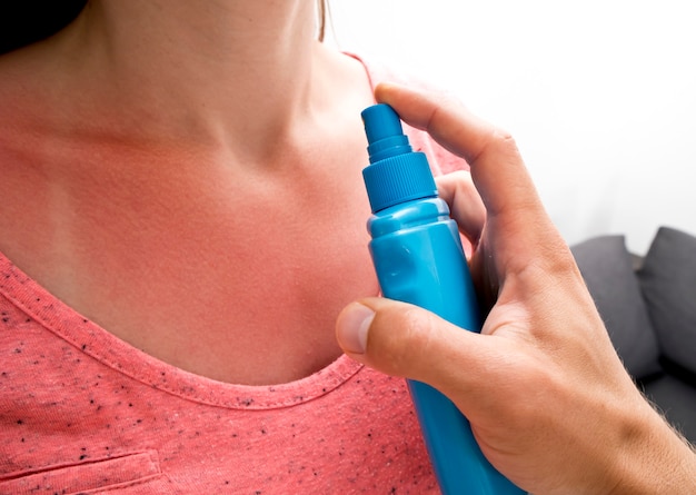 Homem está aplicando o protetor solar na pele da mulher queimada