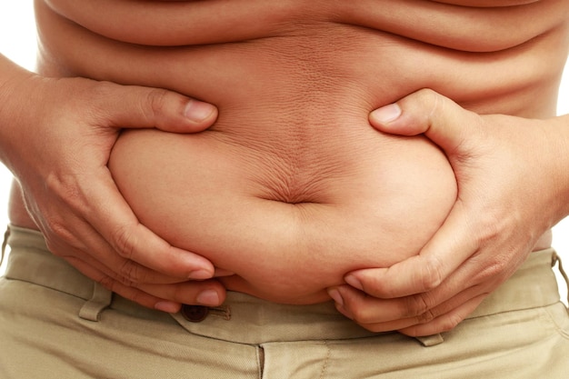 Homem gordo tem excesso de gordura, está fazendo dieta e perdendo peso.
