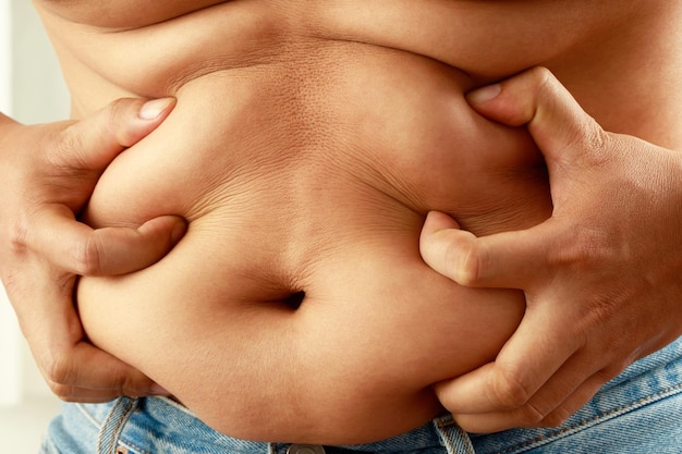 Foto homem gordo tem excesso de gordura, está fazendo dieta e perdendo peso.