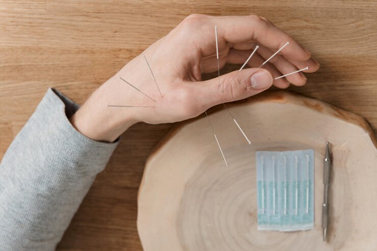 Foto homem usando tratamento de acupuntura para alívio da dor