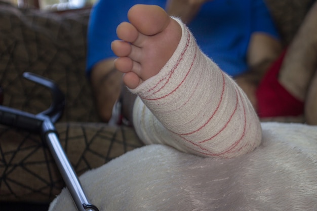 Horizontale Aufnahme eines erwachsenen Mannes mit seinem Bein in Gips und bandagiert auf einem Fußhocker mit Krücken neben ihm. Konzept der Rehabilitation von Menschen nach schweren körperlichen Unfallverletzungen.