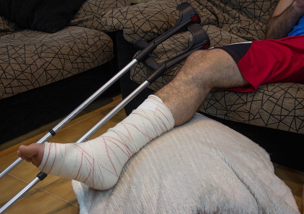 Horizontale Aufnahme eines erwachsenen Mannes mit seinem Bein in Gips und bandagiert auf einem Fußhocker mit Krücken neben ihm. Konzept der Rehabilitation von Menschen nach schweren körperlichen Unfallverletzungen.