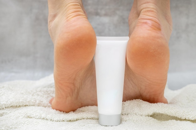 Hornhaut und Hühneraugen, Frauenfuß, Füße, Folge des Tragens unbequemer Schuhe, dermatologische Erkrankungen