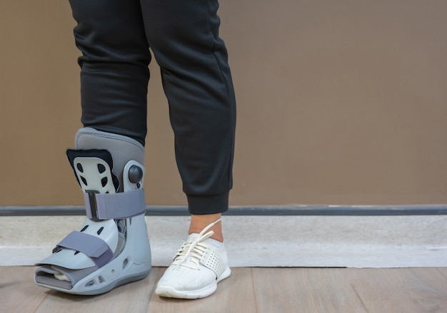 Foto en el hospital, los pacientes sufrían de fractura de tobillo y debían usar una bota ortopédica.