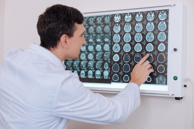 Hübscher angenehmer junger Arzt, der auf das menschliche Gehirn zeigt, das auf dem Röntgenfoto dargestellt wird und es betrachtet, während das Problem gefunden wird