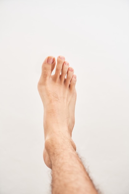 Hueso en el pie Enfermedad de hallux valgus