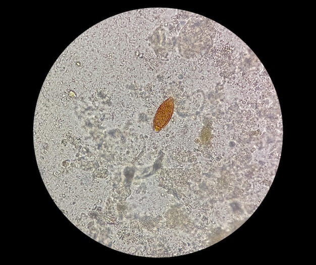 Foto huevos de trichuris trichiura (tricocéfalo) en heces, analizados al microscopio