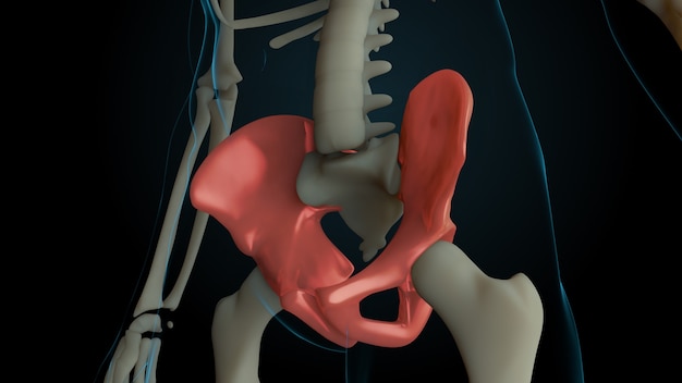 Ilustração 3D renderizada da estrutura do esqueleto com ossos feridos. A dor óssea é mostrada por um brilho vermelho. Dor nos ossos da pelve.