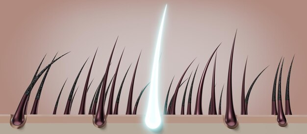 Ilustración 3D del concepto de regeneración de folículos pilosos