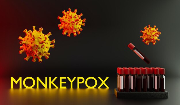 Ilustración de la enfermedad infecciosa de la viruela del simio causada por el virus de la viruela del simio Brote multinacional los nuevos casos Enfermedad zoonótica viral infección peligrosa