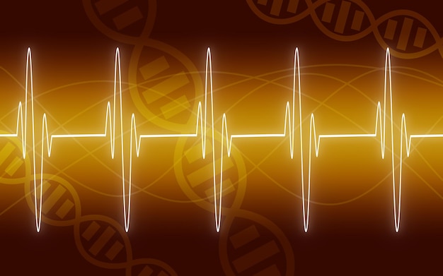 Ilustración de la traza de EKG sobre fondo amarillo