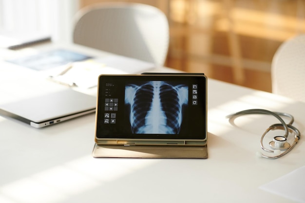 Imagem de raios-X dos pulmões no ecrã