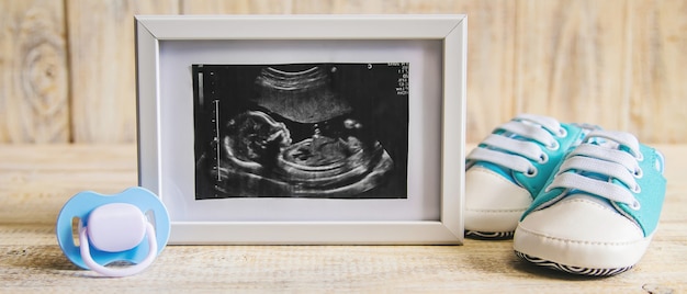 Imagem de ultrassom de uma fotografia e acessórios de um bebê