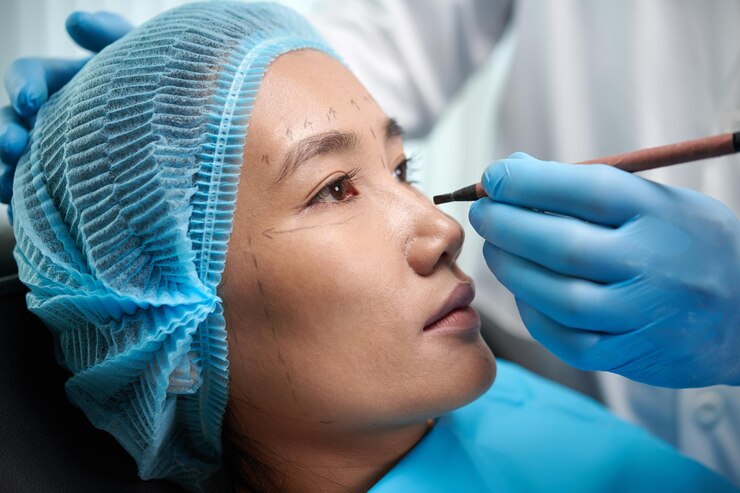 Foto imagem em close-up de um cirurgião desenhando linhas no rosto de uma paciente