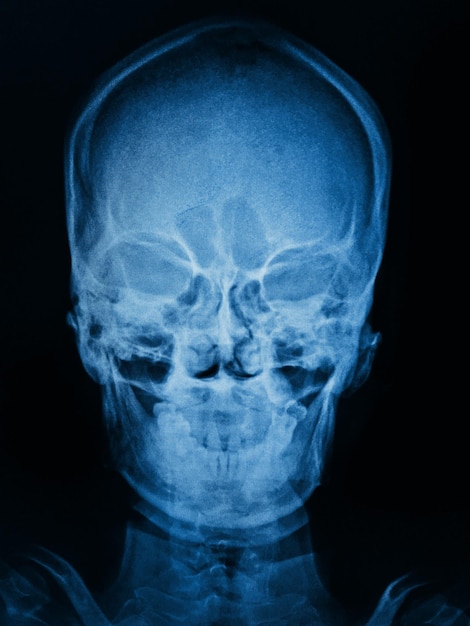 Foto una imagen azul de una calavera con la palabra radio