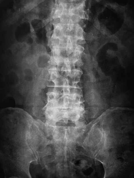 Foto una imagen en blanco y negro de un hombre con una columna vertebral larga.