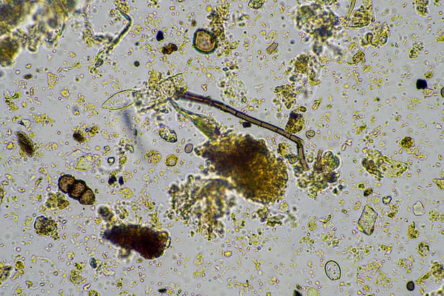 Una imagen de microscopio de una planta con algas y algas sobre ella.