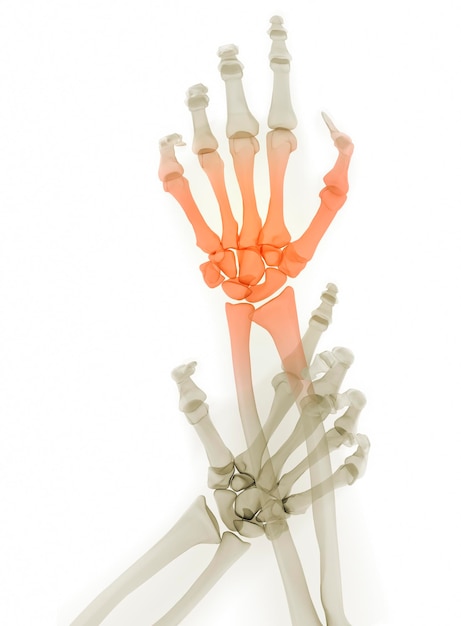 Imagen de rayos X de la articulación de la muñeca y la mano humana