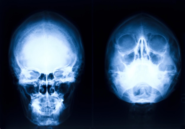 Imagen de rayos X del cráneo humano