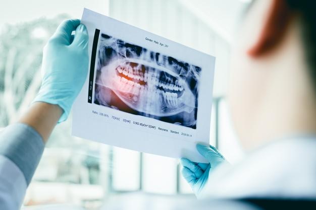 Imagen recortada de un dentista examinando una radiografía